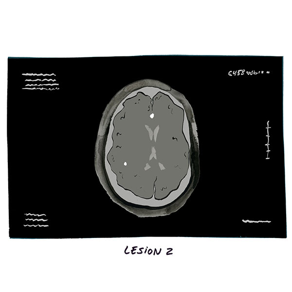 My MRI Comic 2