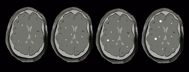 <span class='highlight'>My</span> <span class='highlight'>MRI</span> image